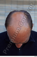  Street  805 bald head 0001.jpg